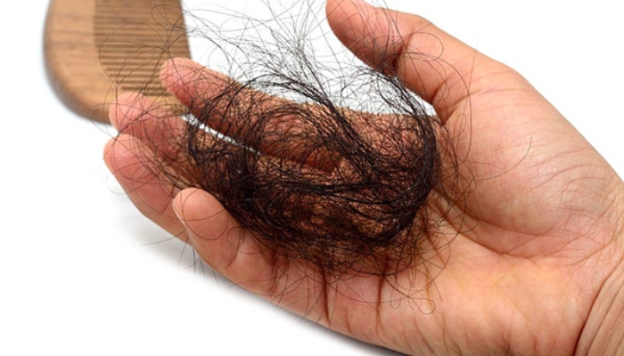 Cách trị rụng tóc nhiều ở người già cực kì hiệu quả